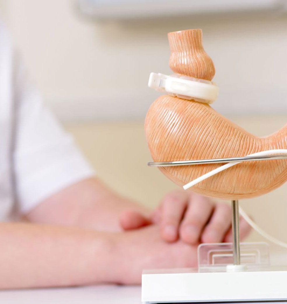 Situaciones especiales en pacientes con cirugía bariátrica